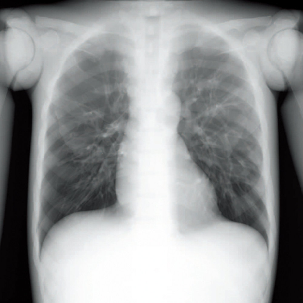 日本KYOTO KAGAKU CT全身模型,PBU-60全身模体