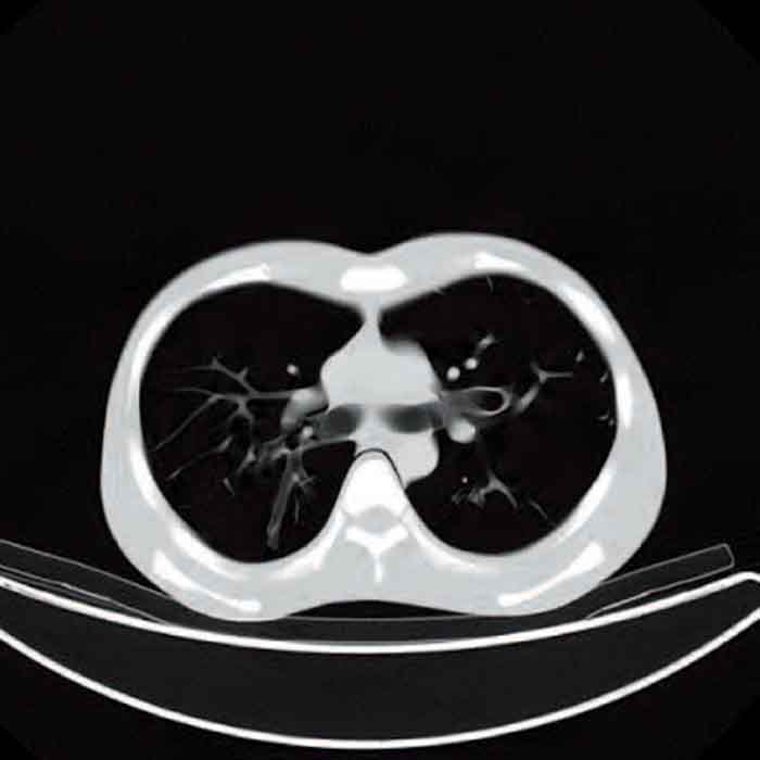 日本KYOTO KAGAKU CT全身模型,PBU-60全身模体