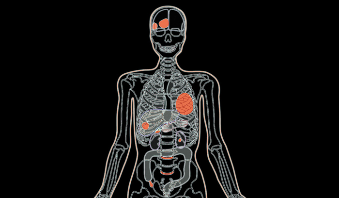 PH-2E 带病理的全身CT模型,日本KYOTO KAGAKU PH-2E多功能放射成像训练模型
