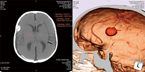 PH-2E 带病理的全身CT模型,日本KYOTO KAGAKU PH-2E多功能放射成像训练模型