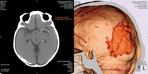 PH-2E 带病理的全身CT模型,日本KYOTO KAGAKU PH-2E多功能放射成像训练模型
