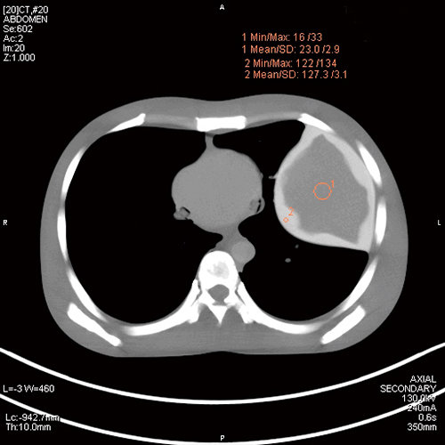 PH-2E 带病理的全身CT模型,日本KYOTO KAGAKU PH-2E多功能放射成像训练模型
