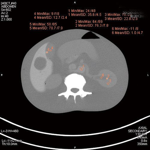 PH-2E 带病理的全身CT模型,日本KYOTO KAGAKU PH-2E多功能放射成像训练模型